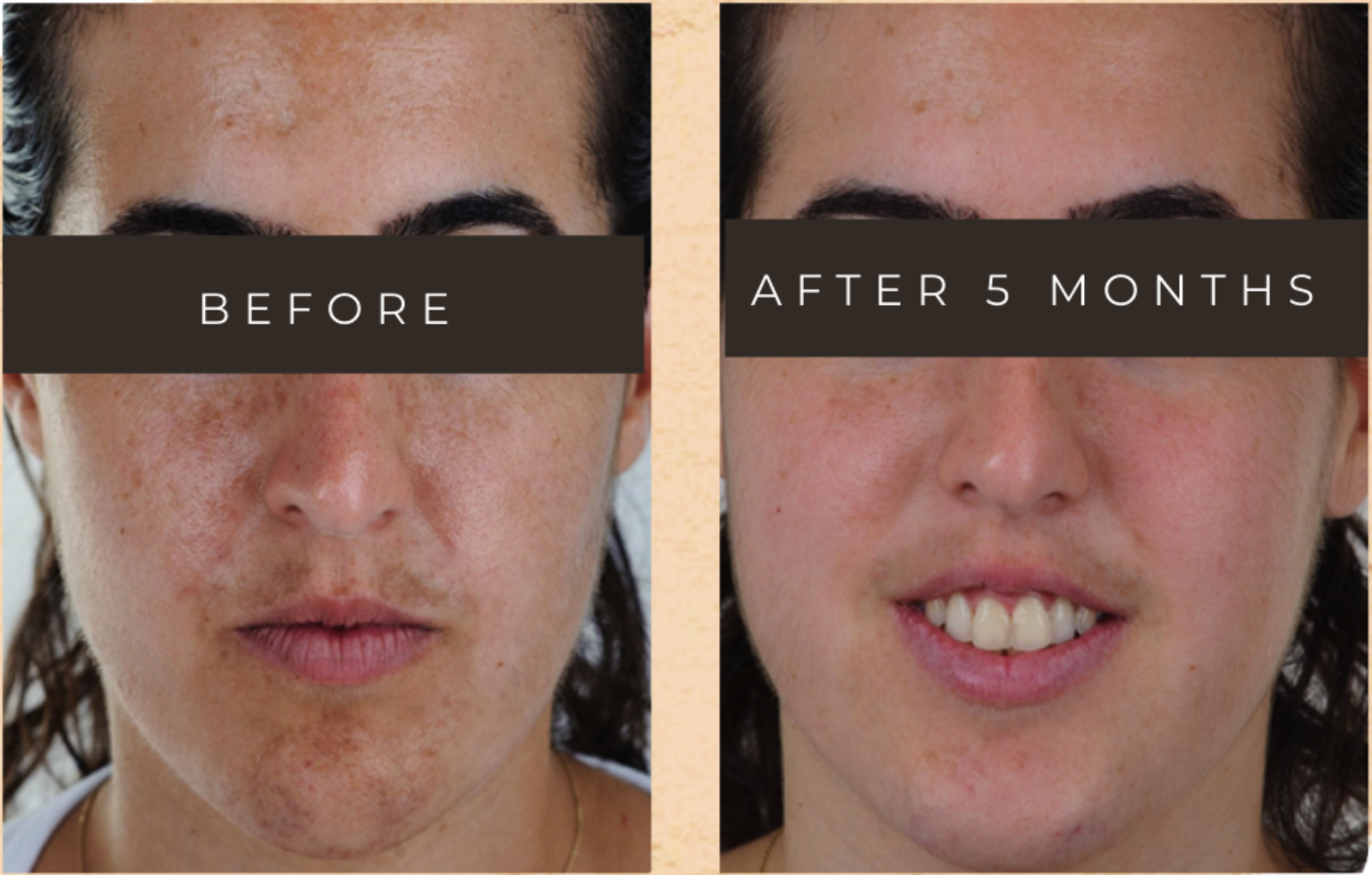 Screenshot 2025-06-11 at 5.07.02 PM